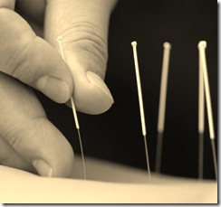 acupuncture3